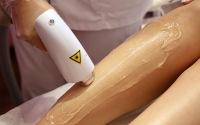 Decouvrez les secrets de l’epilation definitive au laser